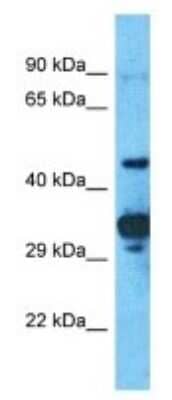 Western Blot: PRAMEF2 Antibody [NBP3-09922]