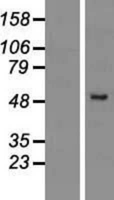 Western Blot: PRAMEF2 Overexpression Lysate [NBL1-14727]