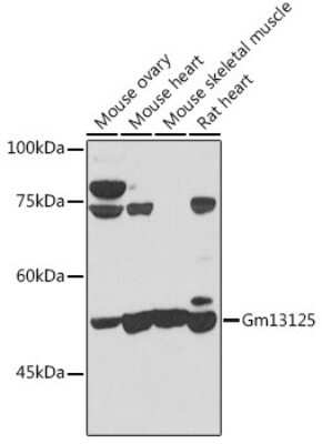 Western Blot: PRAMEF20 AntibodyBSA Free [NBP3-05595]