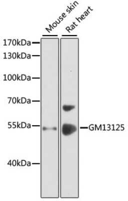 Western Blot: PRAMEF20 AntibodyBSA Free [NBP3-05598]