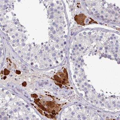 Immunohistochemistry: PRAMEF7 Antibody [NBP2-46778]