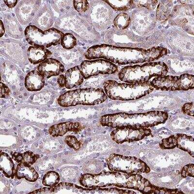 Immunohistochemistry: PRAMEF7 Antibody [NBP2-46791]