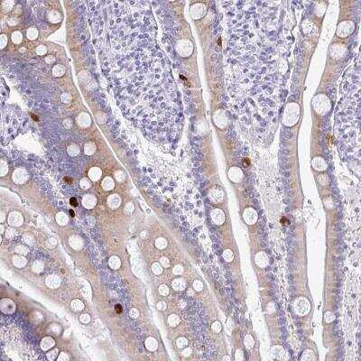 Immunohistochemistry: PRAP1 Antibody [NBP2-46803]