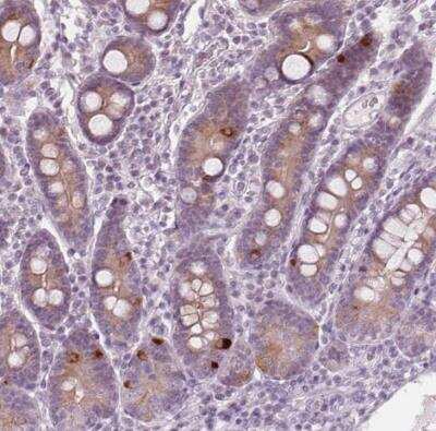 Immunohistochemistry-Paraffin: PRAP1 Antibody [NBP1-80633]