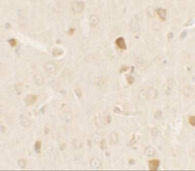 Immunohistochemistry-Paraffin: PRAS40 Antibody - BSA Free [NBP2-41221]