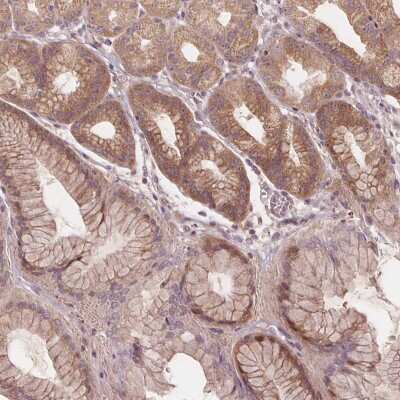 Immunohistochemistry-Paraffin: PRAS40 Antibody [NBP2-57165]