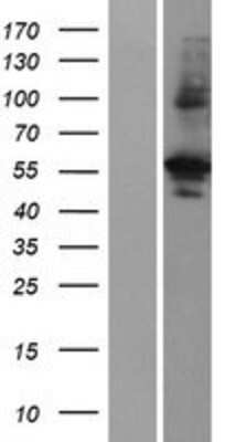 Western Blot: PRAS40 Overexpression Lysate [NBP2-06037]