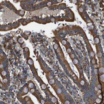 Immunohistochemistry-Paraffin: PRAT4A/TNRC5 Antibody [NBP1-91153]