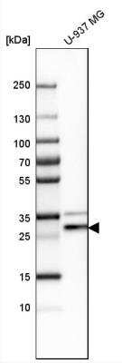 Western Blot: PRAT4A/TNRC5 Antibody [NBP1-91153]