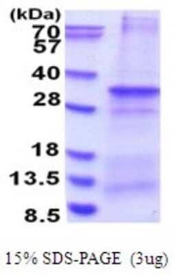 SDS-PAGE: Recombinant Human PRAT4B/CNPY4 His Protein [NBP2-51710]