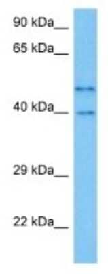 Western Blot: PRB1 Antibody [NBP3-10064]