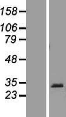 Western Blot: PRB1 Overexpression Lysate [NBP2-04611]