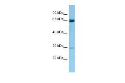 Western Blot: PRB3 Antibody [NBP3-09471]