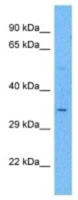 Western Blot: PRB3 Antibody [NBP3-09981]