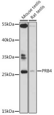 Western Blot: PRB4 AntibodyAzide and BSA Free [NBP3-05584]