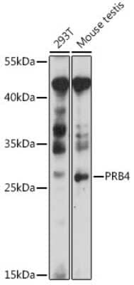 Western Blot: PRB4 AntibodyAzide and BSA Free [NBP3-05585]