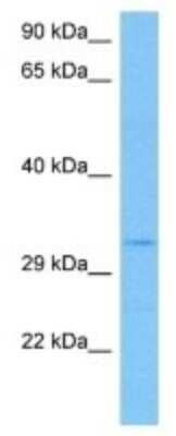 Western Blot: PRB4 Antibody [NBP3-10086]