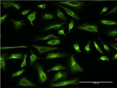 Immunocytochemistry/ Immunofluorescence: PRC1 Antibody (3B10-1F9) [H00009055-M03]