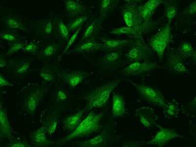 Immunocytochemistry/ Immunofluorescence: PRC1 Antibody [NBP2-99648]