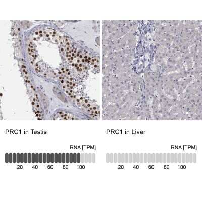 Immunocytochemistry/ Immunofluorescence: PRC1 Antibody [NBP3-17008]