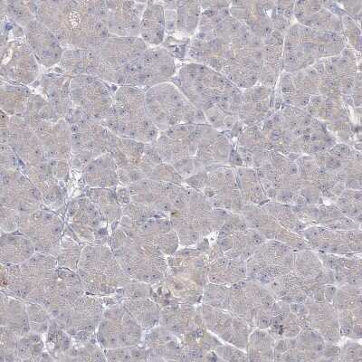 Immunohistochemistry-Paraffin: PRC1 Antibody [NBP1-88856]