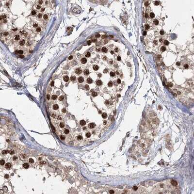 Immunohistochemistry-Paraffin: PRC1 Antibody [NBP1-88856]