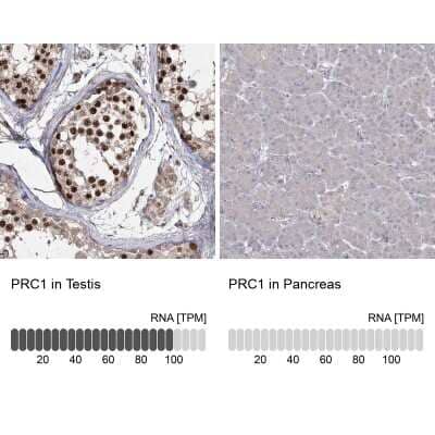 Immunohistochemistry-Paraffin: PRC1 Antibody [NBP1-88856]