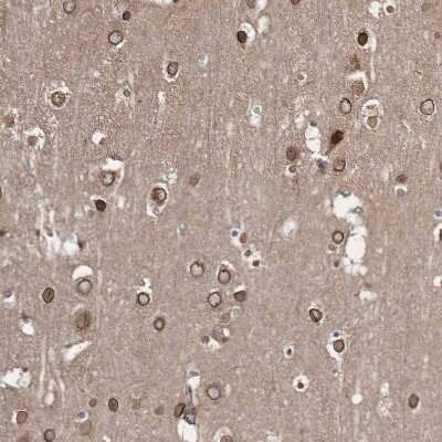 Immunohistochemistry-Paraffin: PRC1 Antibody [NBP1-88856]