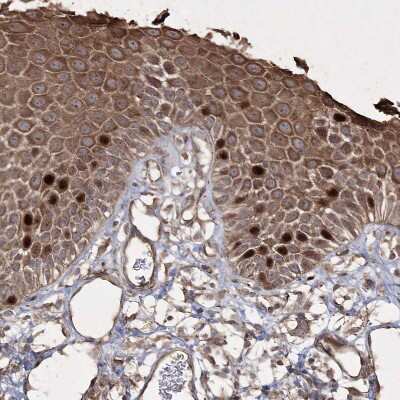 Immunohistochemistry-Paraffin: PRC1 Antibody [NBP1-88856]