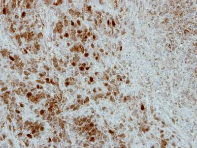 Immunohistochemistry-Paraffin: PRC1 Antibody [NBP2-19925]