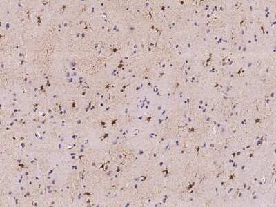 Immunohistochemistry-Paraffin: PRC1 Antibody [NBP2-99648]