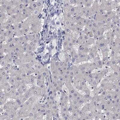 Immunohistochemistry-Paraffin: PRC1 Antibody [NBP3-17008]
