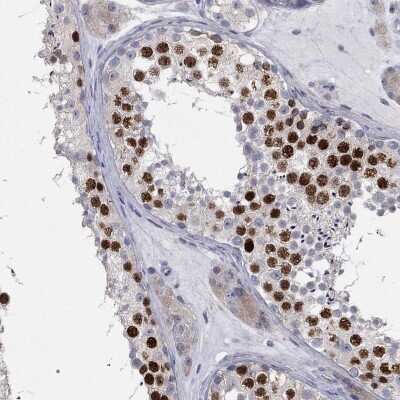 Immunohistochemistry-Paraffin: PRC1 Antibody [NBP3-17008]