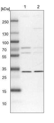 Western Blot: PRC1 Antibody [NBP1-88856]