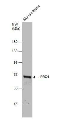 Western Blot: PRC1 Antibody [NBP2-19925]