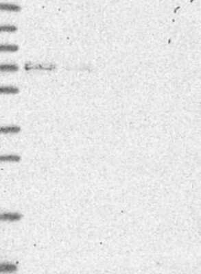 Western Blot: PRC1 Antibody [NBP3-17008]