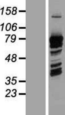 Western Blot: PRC1 Overexpression Lysate [NBL1-14729]