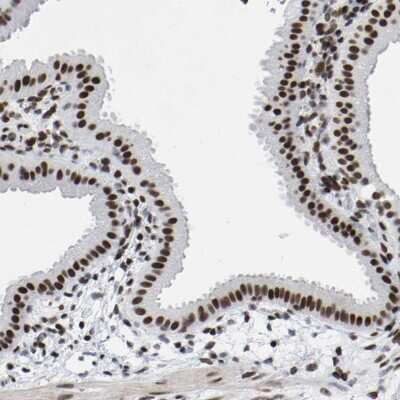 Immunohistochemistry-Paraffin: PRCC Antibody [NBP1-87152]
