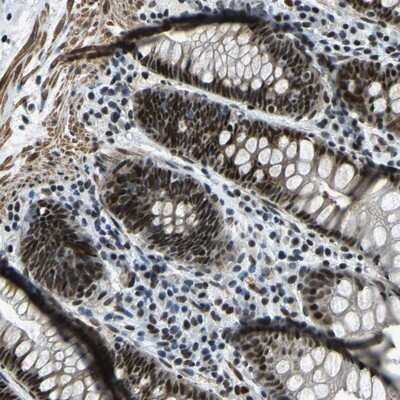 Immunohistochemistry-Paraffin: PRCC Antibody [NBP1-87153]