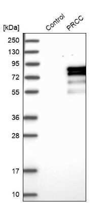 Western Blot: PRCC Antibody [NBP1-87153]