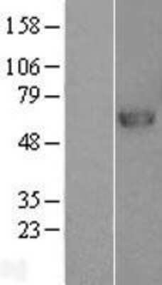 Western Blot: Lysosomal Pro-X Carboxypeptidase/PRCP Overexpression Lysate [NBL1-14731]