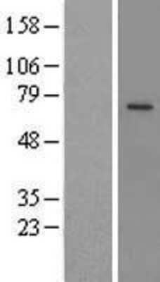 Western Blot: Lysosomal Pro-X Carboxypeptidase/PRCP Overexpression Lysate [NBL1-14732]