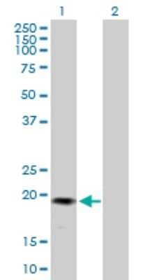 Western Blot: PRDC/GREM2 Antibody [H00064388-B01P]