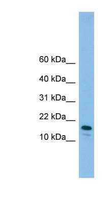 Western Blot: PRDC/GREM2 Antibody [NBP1-57598]