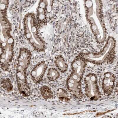 Immunohistochemistry-Paraffin: PRDM10 Antibody [NBP1-81427]