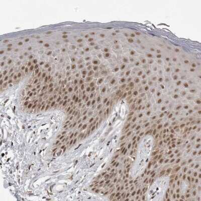Immunohistochemistry-Paraffin: PRDM10 Antibody [NBP1-81427]