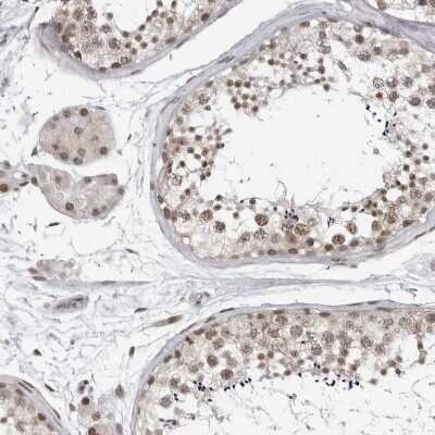 Immunohistochemistry-Paraffin: PRDM10 Antibody [NBP1-81427]