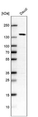 Western Blot: PRDM10 Antibody [NBP1-81427]