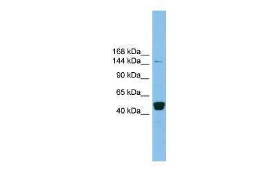 Western Blot: PRDM10 Antibody [NBP2-85526]