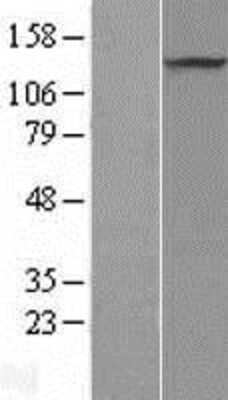 Western Blot: PRDM10 Overexpression Lysate [NBL1-14734]